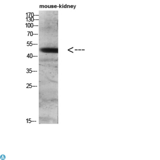 LAMP3 / CD208 Antibody - Western blot analysis of mouse kidney lysate, antibody was diluted at 500. Secondary antibody was diluted at 1:20000.