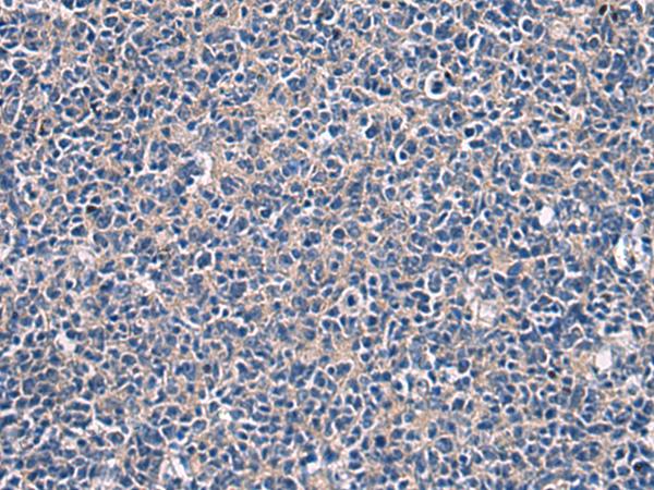 LAMP3 / CD208 Antibody - Immunohistochemistry of paraffin-embedded Human tonsil tissue  using LAMP3 Polyclonal Antibody at dilution of 1:30(×200)