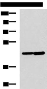 LAMP3 / CD208 Antibody - Western blot analysis of Hela and Jurkat cell lysates  using LAMP3 Polyclonal Antibody at dilution of 1:600