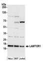 LAMTOR1 Antibody - Detection of human LAMTOR1 by western blot. Samples: Whole cell lysate (50 µg) from HeLa, HEK293T, and Jurkat cells prepared using NETN lysis buffer. Antibody: Affinity purified rabbit anti-LAMTOR1 antibody used for WB at 0.4 µg/ml. Detection: Chemiluminescence with an exposure time of 30 seconds.