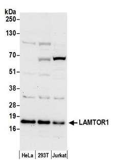 LAMTOR1 Antibody - Detection of human LAMTOR1 by western blot. Samples: Whole cell lysate (50 µg) from HeLa, HEK293T, and Jurkat cells prepared using NETN lysis buffer. Antibody: Affinity purified rabbit anti-LAMTOR1 antibody used for WB at 0.4 µg/ml. Detection: Chemiluminescence with an exposure time of 30 seconds.