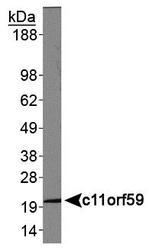 LAMTOR1 Antibody - C11orf59 Antibody - WB analysis of c11orf59 in human liver protein.