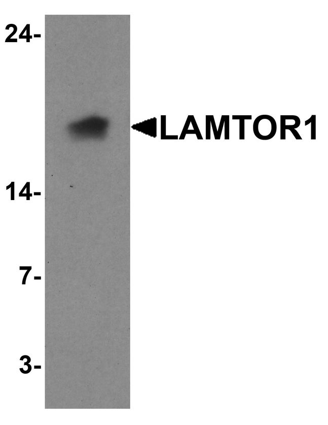 LAMTOR1 Antibody - Western blot analysis of LAMTOR1 in A431 cell lysate with LAMTOR1 antibody at 1 ug/ml.