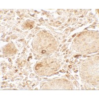 LAMTOR1 Antibody - Immunohistochemistry of LAMTOR1 in human small intestine tissue with LAMTOR1 antibody at 5 µg/mL.