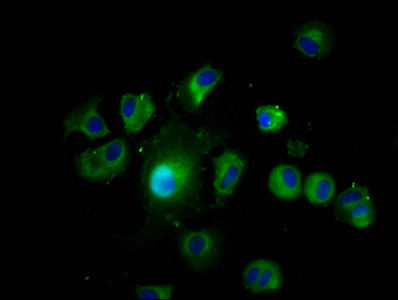 LAMTOR1 Antibody - Immunofluorescence staining of MCF-7 cells diluted at 1:200, counter-stained with DAPI. The cells were fixed in 4% formaldehyde, permeabilized using 0.2% Triton X-100 and blocked in 10% normal Goat Serum. The cells were then incubated with the antibody overnight at 4°C.The Secondary antibody was Alexa Fluor 488-congugated AffiniPure Goat Anti-Rabbit IgG (H+L).