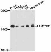 LAMTOR1 Antibody - Western blot analysis of extracts of various cell lines, using LAMTOR1 antibody at 1:3000 dilution. The secondary antibody used was an HRP Goat Anti-Rabbit IgG (H+L) at 1:10000 dilution. Lysates were loaded 25ug per lane and 3% nonfat dry milk in TBST was used for blocking. An ECL Kit was used for detection and the exposure time was 90s.