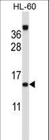 LAMTOR2 Antibody - ROBLD3 Antibody western blot of HL-60 cell line lysates (35 ug/lane). The ROBLD3 antibody detected the ROBLD3 protein (arrow).