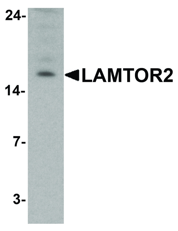 LAMTOR2 Antibody - Western blot analysis of LAMTOR2 in HepG2 cell lysate with LAMTOR2 antibody at 1 ug/ml.