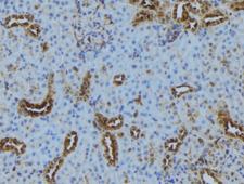 LAMTOR2 Antibody - 1:100 staining mouse kidney tissue by IHC-P. The sample was formaldehyde fixed and a heat mediated antigen retrieval step in citrate buffer was performed. The sample was then blocked and incubated with the antibody for 1.5 hours at 22°C. An HRP conjugated goat anti-rabbit antibody was used as the secondary.