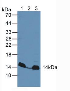 LAMTOR3 / MP1 Antibody - Western Blot; Sample: Lane1: Rat Heart Tissue; Lane2: Human Liver Tissue; Lane3: Mouse Liver Tissue.