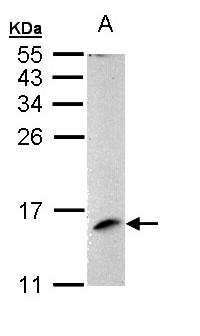 LAMTOR3 / MP1 Antibody - Sample (30 ug of whole cell lysate). A:293T. 15% SDS PAGE. LAMTOR3 / MP1 antibody diluted at 1:1000.
