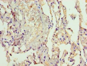 LAMTOR3 / MP1 Antibody - Immunohistochemistry of paraffin-embedded human lung using antibody at 1:100 dilution.