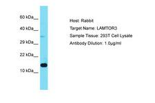 LAMTOR3 / MP1 Antibody -  This image was taken for the unconjugated form of this product. Other forms have not been tested.
