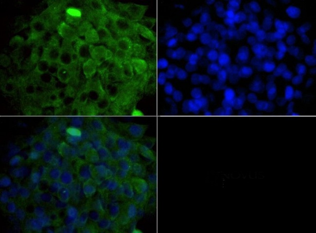 LAMTOR3 / MP1 Antibody - Immunocytochemistry/Immunofluorescence: MAP2K1IP1/MAPKSP1 Antibody - ICC staining of MAP2K1IP1 in HepG2 cells with FITC (green). Nuclei were counterstained with DAPI (blue).  This image was taken for the unconjugated form of this product. Other forms have not been tested.