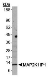 LAMTOR3 / MP1 Antibody - Western Blot: MAP2K1IP1/MAPKSP1 Antibody - WB detection of MAP2K1IP1 in A431 whole cell lysates.  This image was taken for the unconjugated form of this product. Other forms have not been tested.