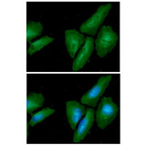 LAMTOR3 / MP1 Antibody - ICC/IF analysis of MAPKSP1 in HaLa cells. The cell was stained with  MAPKSP1 antibody (1:100).The secondary antibody (green) was used Alexa Fluor 488. DAPI was stained the cell nucleus (blue).