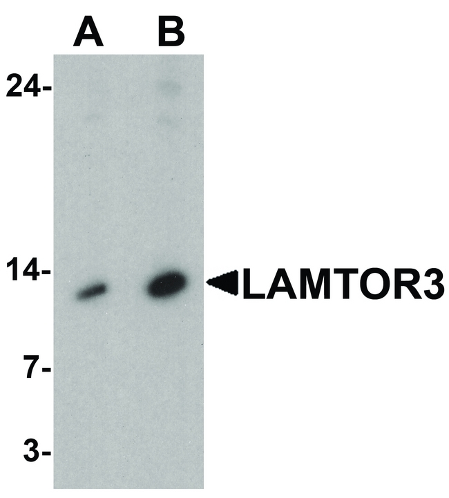 LAMTOR3 / MP1 Antibody - Western blot analysis of LAMTOR3 in human brain tissue lysate with LAMTOR3 antibody at (A) 1 and (B) 2 ug/ml