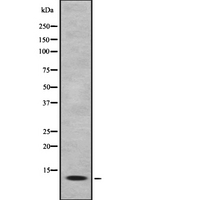 LAMTOR3 / MP1 Antibody - Western blot analysis of MK1I1 expression in HEK293 cells. The lane on the left is treated with the antigen-specific peptide.