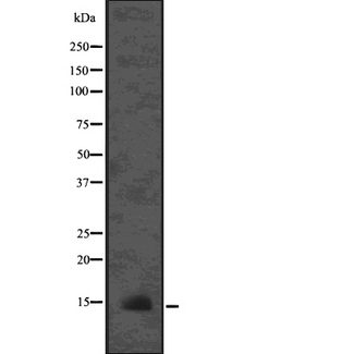 LAMTOR3 / MP1 Antibody - Western blot analysis of LAMTOR3 using mouse brain lysates.