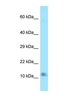 LAMTOR4 Antibody - 0910001L09Rik antibody Western blot of Mouse Heart lysate. Antibody concentration 1 ug/ml.  This image was taken for the unconjugated form of this product. Other forms have not been tested.