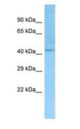 LANCL1 Antibody - LANCL1 antibody Western Blot of Human Kidney.  This image was taken for the unconjugated form of this product. Other forms have not been tested.