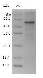 CES1P1 / CES4 Protein - (Tris-Glycine gel) Discontinuous SDS-PAGE (reduced) with 5% enrichment gel and 15% separation gel.