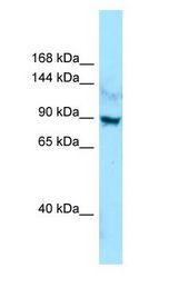 LAP1 / LRRC7 Antibody - LAP1 / LRRC7 antibody Western Blot of Jurkat.  This image was taken for the unconjugated form of this product. Other forms have not been tested.