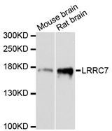 LAP1 / LRRC7 Antibody - Western blot analysis of extracts of various cell lines, using LRRC7 antibody at 1:3000 dilution. The secondary antibody used was an HRP Goat Anti-Rabbit IgG (H+L) at 1:10000 dilution. Lysates were loaded 25ug per lane and 3% nonfat dry milk in TBST was used for blocking. An ECL Kit was used for detection and the exposure time was 90s.