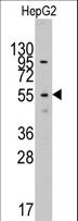LAP3 Antibody - Western blot of anti-LAP3 antibody in HepG2 cell line lysates (35 ug/lane). LAP3(arrow) was detected using the purified antibody.