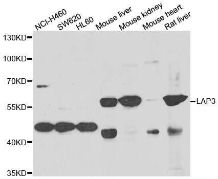 LAP3 Antibody - Western blot analysis of extracts of various cell lines.