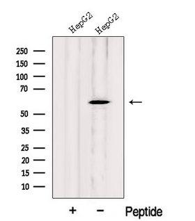 LAP3 Antibody - Western blot analysis of extracts of HepG2 cells using LAP3 antibody. The lane on the left was treated with blocking peptide.