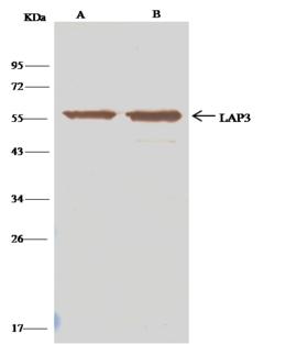 LAP3 Antibody - LAP3-His(C) was immunoprecipitated using: Lane A: 0.5 mg Hela Whole Cell Lysate. Lane B: 0.5 mg HepG2 Whole Cell Lysate. 4 uL anti-LAP3-His(C) rabbit polyclonal antibody and 15 ul of 50% Protein G agarose. Primary antibody: Anti-LAP3-His(C) rabbit polyclonal antibody, at 1:100 dilution. Secondary antibody: Clean-Blot IP Detection Reagent (HRP) at 1:500 dilution. Developed using the DAB staining technique. Performed under reducing conditions. Predicted band size: 56 kDa. Observed band size: 56 kDa.
