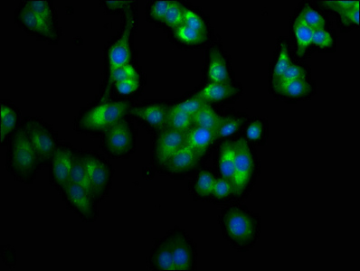 LAPTM4A Antibody - Immunofluorescence staining of HepG2 cells at a dilution of 1:100, counter-stained with DAPI. The cells were fixed in 4% formaldehyde, permeabilized using 0.2% Triton X-100 and blocked in 10% normal Goat Serum. The cells were then incubated with the antibody overnight at 4 °C.The secondary antibody was Alexa Fluor 488-congugated AffiniPure Goat Anti-Rabbit IgG (H+L) .