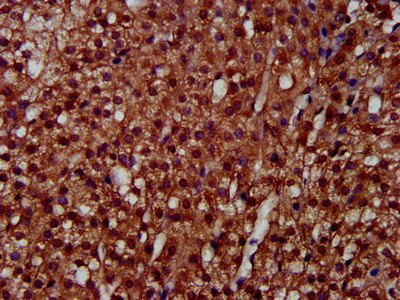 LAPTM4A Antibody - Immunohistochemistry image at a dilution of 1:300 and staining in paraffin-embedded human adrenal gland tissue performed on a Leica BondTM system. After dewaxing and hydration, antigen retrieval was mediated by high pressure in a citrate buffer (pH 6.0) . Section was blocked with 10% normal goat serum 30min at RT. Then primary antibody (1% BSA) was incubated at 4 °C overnight. The primary is detected by a biotinylated secondary antibody and visualized using an HRP conjugated SP system.