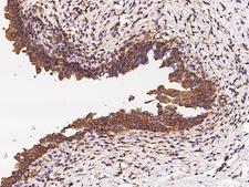 LAPTM4A Antibody - Immunochemical staining LAPTM4A in human bladder with rabbit polyclonal antibody at 1:300 dilution, formalin-fixed paraffin embedded sections.
