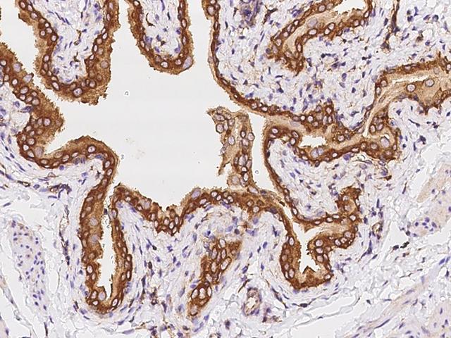 LAPTM4A Antibody - Immunochemical staining LAPTM4A in rat bladder with rabbit polyclonal antibody at 1:300 dilution, formalin-fixed paraffin embedded sections.