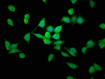LAPTM4B Antibody - Immunofluorescence staining of SH-SY5Y cells at a dilution of 1:200, counter-stained with DAPI. The cells were fixed in 4% formaldehyde, permeabilized using 0.2% Triton X-100 and blocked in 10% normal Goat Serum. The cells were then incubated with the antibody overnight at 4°C.The secondary antibody was Alexa Fluor 488-congugated AffiniPure Goat Anti-Rabbit IgG (H+L) .