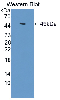 LARGE Antibody - Western blot of LARGE antibody.