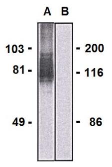 LARGE Antibody - Western blotting analysis of LARGE1 in HEK293-LARGE1 transfectants (A) and HEK293 cells (B) using mouse monoclonal antibody (clone LARGE-02).