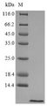 HAMP / Hepcidin Protein - (Tris-Glycine gel) Discontinuous SDS-PAGE (reduced) with 5% enrichment gel and 15% separation gel.