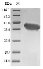 OPRT Protein - (Tris-Glycine gel) Discontinuous SDS-PAGE (reduced) with 5% enrichment gel and 15% separation gel.