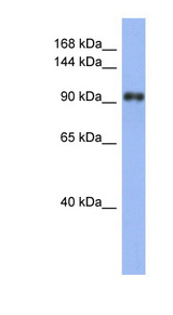 LARP1 / La-Related Protein 1 Antibody - LARP1 / LARP antibody Western blot of Fetal Stomach lysate. This image was taken for the unconjugated form of this product. Other forms have not been tested.