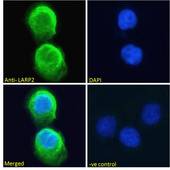 LARP1B Antibody - LARP2 / LARP1B antibody immunofluorescence analysis of paraformaldehyde fixed A431 cells, permeabilized with 0.15% Triton. Primary incubation 1hr (10ug/ml) followed by Alexa Fluor 488 secondary antibody (2ug/ml), showing cytoplasmic staining. The nuclear stain is DAPI (blue). Negative control: Unimmunized goat IgG (10ug/ml) followed by Alexa Fluor 488 secondary antibody (2ug/ml).