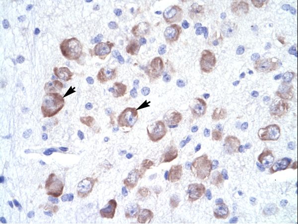 LARP1B Antibody - LARP1B / LARP2 antibody ARP34532_T100-NP_056130-LARP2 (La ribonucleoprotein domain family, member 2) Antibody was used in IHC to stain formalin-fixed, paraffin-embedded human brain.  This image was taken for the unconjugated form of this product. Other forms have not been tested.