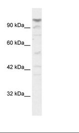 LARP1B Antibody - HepG2 Cell Lysate.  This image was taken for the unconjugated form of this product. Other forms have not been tested.