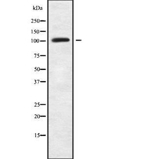 LARP1B Antibody - Western blot analysis of LARP2 using HuvEc whole cells lysates