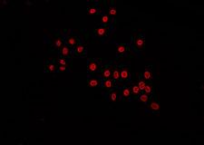 LARP1B Antibody - Staining HeLa cells by IF/ICC. The samples were fixed with PFA and permeabilized in 0.1% Triton X-100, then blocked in 10% serum for 45 min at 25°C. The primary antibody was diluted at 1:200 and incubated with the sample for 1 hour at 37°C. An Alexa Fluor 594 conjugated goat anti-rabbit IgG (H+L) Ab, diluted at 1/600, was used as the secondary antibody.