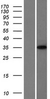 LARP1B Protein - Western validation with an anti-DDK antibody * L: Control HEK293 lysate R: Over-expression lysate