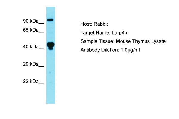 LARP4B Antibody -  This image was taken for the unconjugated form of this product. Other forms have not been tested.