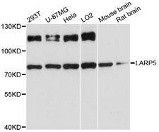 LARP4B Antibody - Western blot analysis of extracts of various cell lines, using LARP5 antibody at 1:3000 dilution. The secondary antibody used was an HRP Goat Anti-Rabbit IgG (H+L) at 1:10000 dilution. Lysates were loaded 25ug per lane and 3% nonfat dry milk in TBST was used for blocking. An ECL Kit was used for detection and the exposure time was 90s.